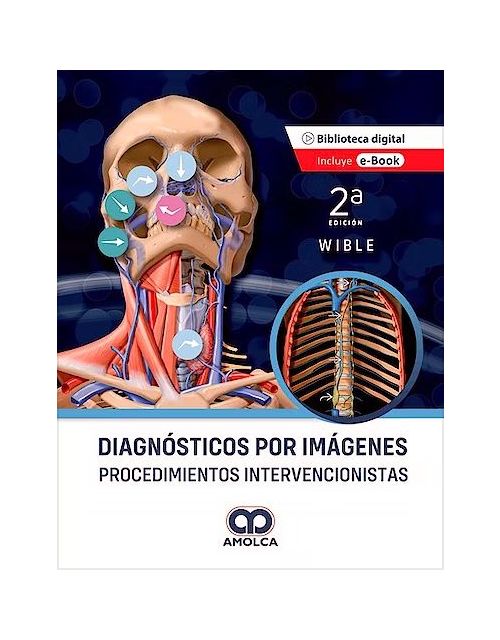 Diagnósticos por Imágenes. Procedimientos Intervencionistas