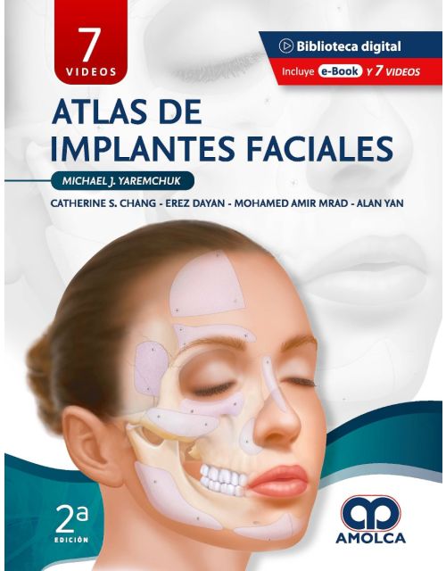 Atlas de Implantes Faciales