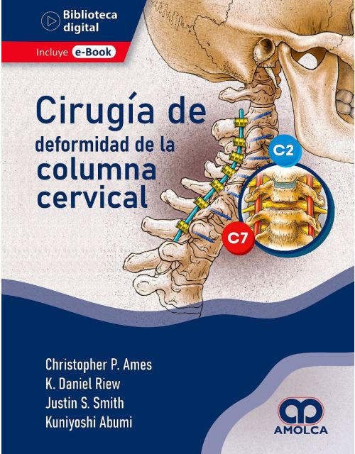 Cirugía de la Deformidad de la Columna Cervical