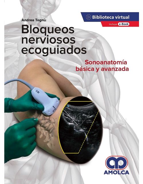 Bloqueos Nerviosos Ecoguiados