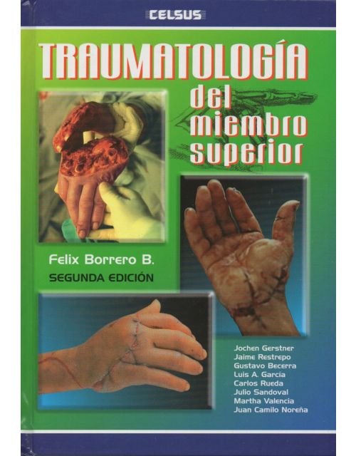 Traumatología Del Miembro Superior