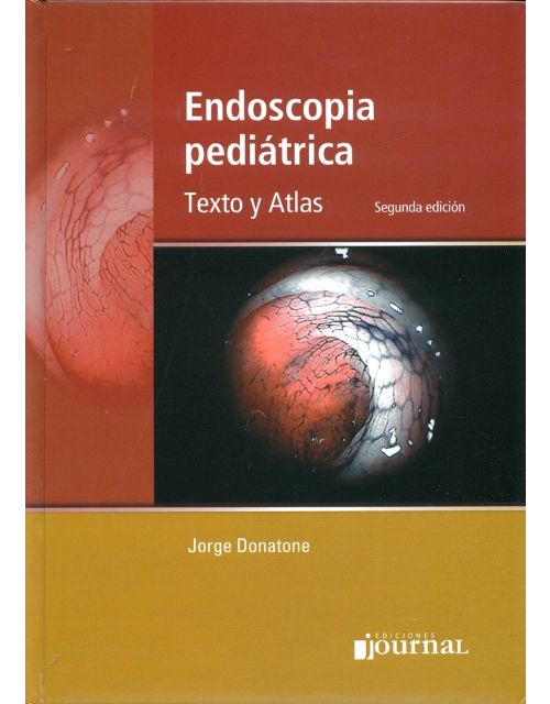 Endoscopia Pediátrica