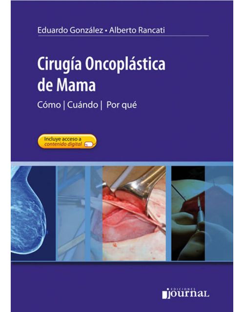 Cirugía Oncoplástica de Mama. Cómo, Cuándo, Por qué