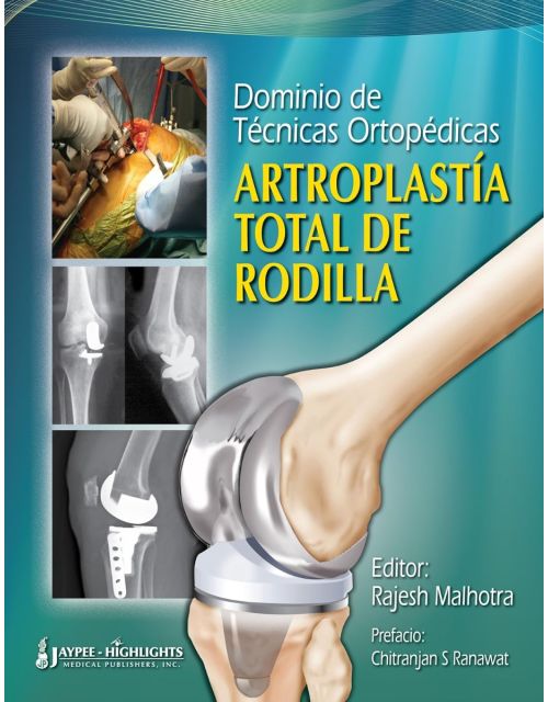 Dominio de Técnicas Ortopédicas: Artroplastía Total de Rodilla 