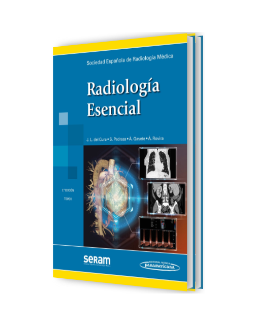 Radiología Esencial 2 Tomos