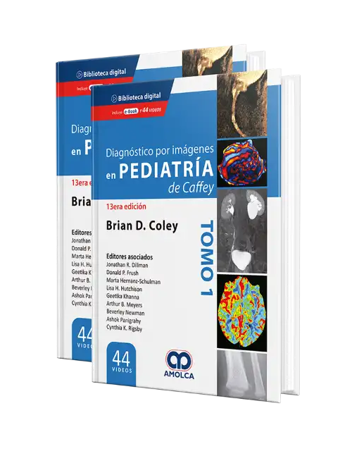 Diagnóstico por Imágenes en Pediatría 2 vol.